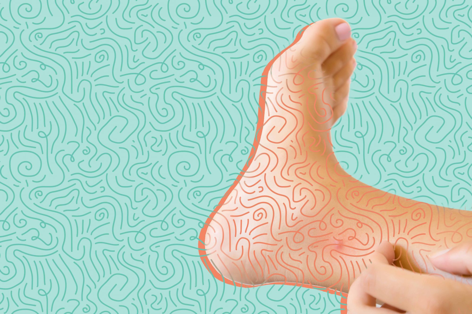 Penyakit Cacing Tambang